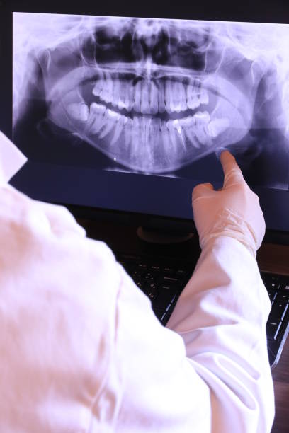 Best Broken or Chipped Tooth Repair in New Baden, IL
